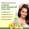 Mamaearth Lemon Anti-Dandruff Hair Oil for Flaky Scalp Scalp