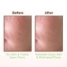 Mamaearth Rice Water Dewy Face Toner with Rice Water & 4% Niacinamide