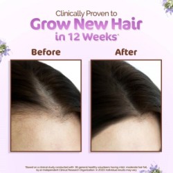 Mamaearth Rosemary Hair Growth Oil with Rosemary & Methi Dana