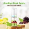 Mamaearth Bye Bye Blemishes Face Cream, for Pigmentation & Blemish